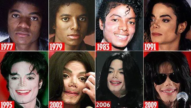 Michael Jackson neden beyaz oldu? Beyaz olmayı istemesenin felsefi arka planı