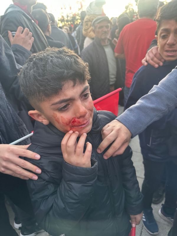 Ekrem İmamoğlu'nun Erzurum mitingine saldırı